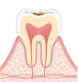 C1